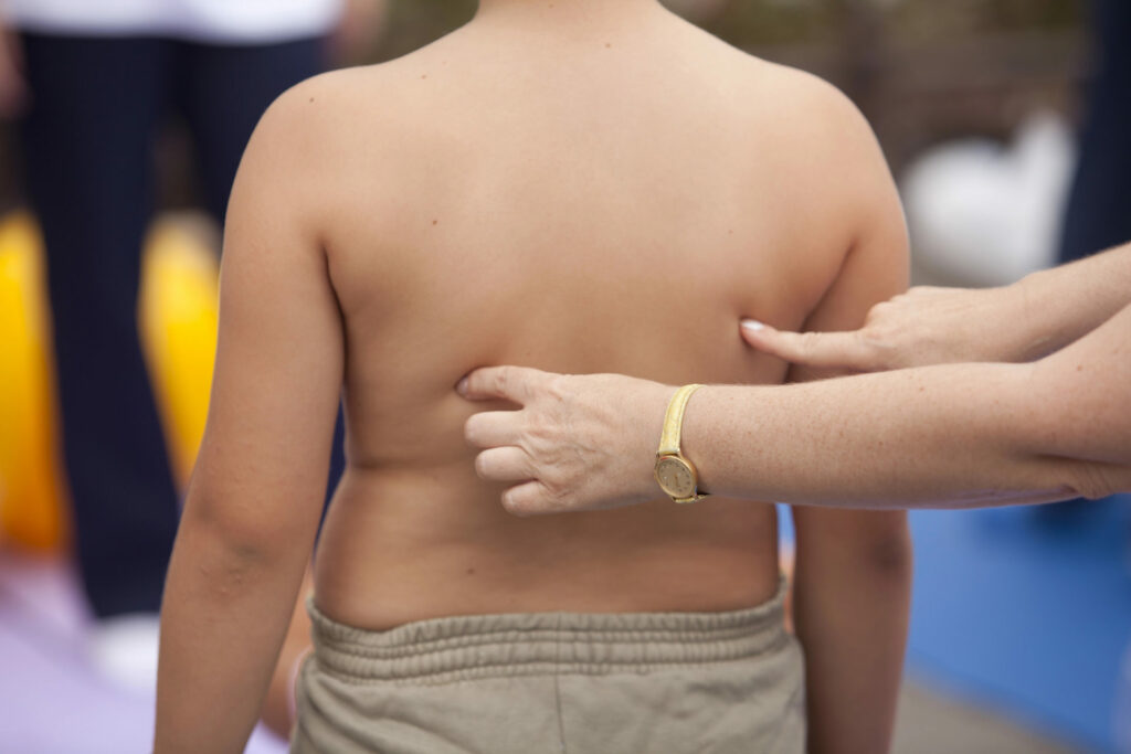 Il caso. Epidemia di obesità, come si ferma?